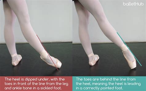 what is a sickled foot in dance? the intricate connection between ballet and modern dance techniques