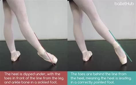 What is Sickle Feet in Dance? And How Does It Relate to the Evolution of Dance Techniques?